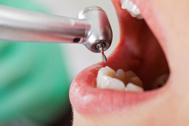 Best Dentist Open Late Near Me  in Bedford, IN
